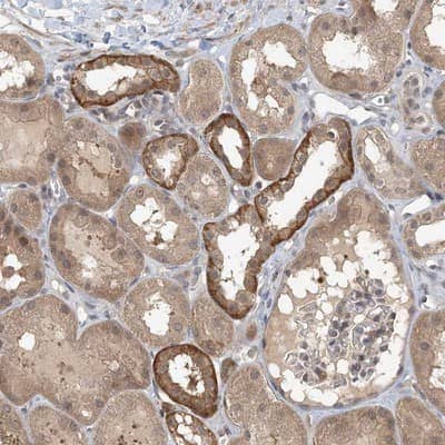 Immunohistochemistry-Paraffin: MCPIP1/ZC3H12A Antibody [NBP1-83587]