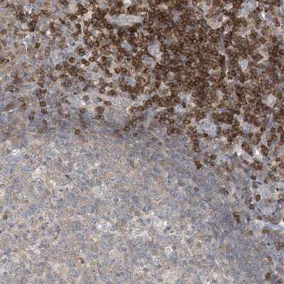 Immunohistochemistry-Paraffin: MCPIP1/ZC3H12A Antibody [NBP2-37871]