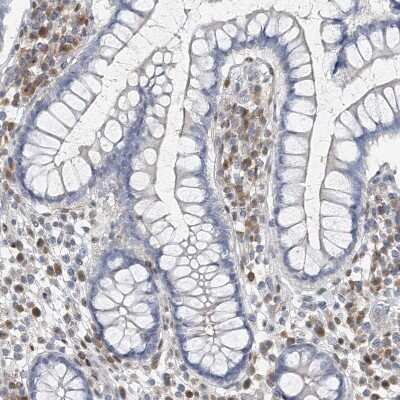 Immunohistochemistry-Paraffin: MCPIP1/ZC3H12A Antibody [NBP2-37871]