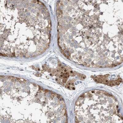 Immunohistochemistry-Paraffin: MCPIP1/ZC3H12A Antibody [NBP2-37871]