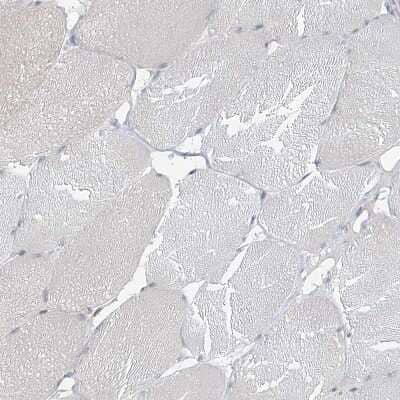 Immunohistochemistry-Paraffin: MCPIP1/ZC3H12A Antibody [NBP2-37871]
