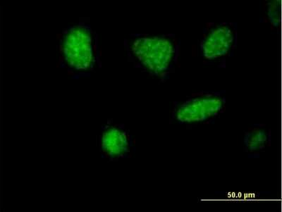 Immunocytochemistry/ Immunofluorescence: MCRS1 Antibody [H00010445-B01P]