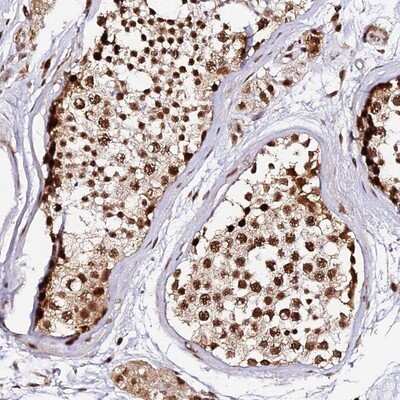 Immunohistochemistry-Paraffin: MCRS1 Antibody [NBP1-81615]