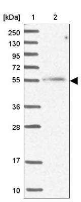 Western Blot: MCRS1 Antibody [NBP1-81615]