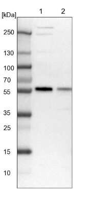 Western Blot: MCRS1 Antibody [NBP1-81615]