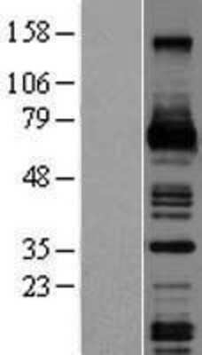 Western Blot: M-CSF Overexpression Lysate [NBL1-09513]