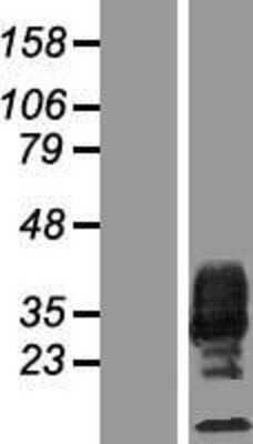 Western Blot: M-CSF Overexpression Lysate [NBP2-05168]