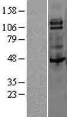 Western Blot: M-CSFR/CD115 Overexpression Lysate [NBL1-09514]