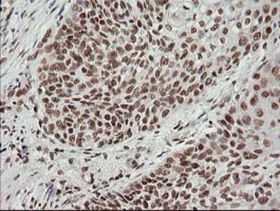 Immunohistochemistry-Paraffin: MCTS1 Antibody (OTI2F9) [NBP2-03626]
