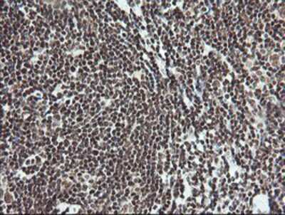 Immunohistochemistry-Paraffin: MCTS1 Antibody (OTI2F9) [NBP2-03626]