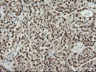 Immunohistochemistry-Paraffin: MCTS1 Antibody (OTI2F9) [NBP2-03626]