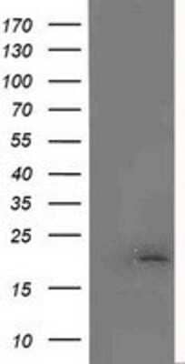 Western Blot: MCTS1 Antibody (OTI2F9) [NBP2-03626]