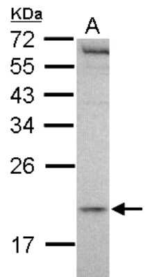 Western Blot: MCTS1 Antibody [NBP2-17242]