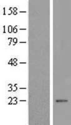 Western Blot: MCTS1 Overexpression Lysate [NBL1-12962]