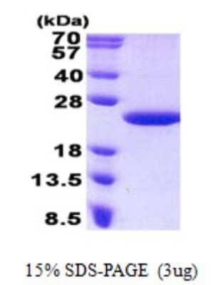 SDS-PAGE: Recombinant Human MCTS1 His Protein [NBP2-23214]