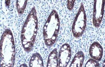 Immunohistochemistry-Paraffin: MCT1/SLC16A1 Antibody (14612) [NBP2-43838]