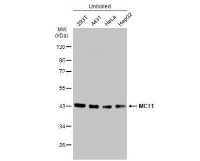 Western Blot: MCT1/SLC16A1 Antibody (14612) [NBP2-43838]