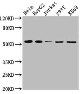 Western Blot: MCT1/SLC16A1 Antibody (9D12) [NBP3-15184]