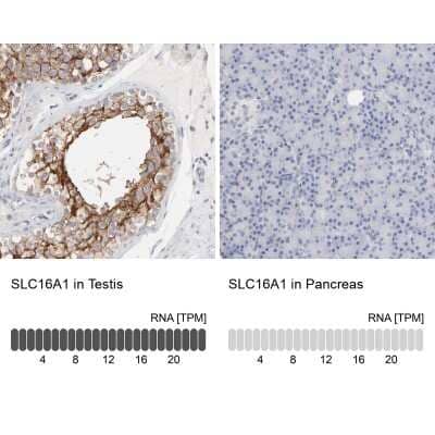 Immunohistochemistry-Paraffin: MCT1/SLC16A1 Antibody [NBP1-89574]