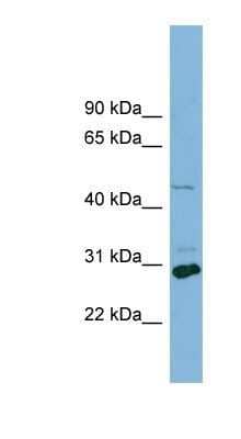 Western Blot: MCT1/SLC16A1 Antibody [NBP1-59879]