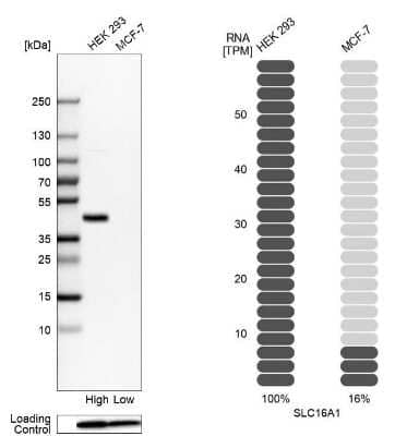 Western Blot: MCT1/SLC16A1 Antibody [NBP1-89574]