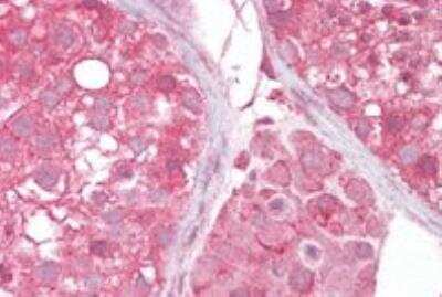 Immunohistochemistry-Paraffin: MCT2 Antibody [NB300-877]