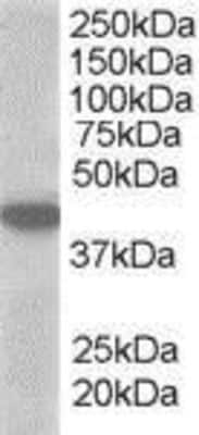 Western Blot: MCT2 Antibody [NB300-877]