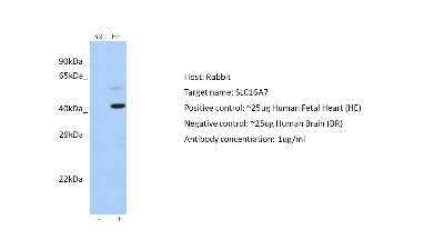 Western Blot: MCT2 Antibody [NBP2-85265]