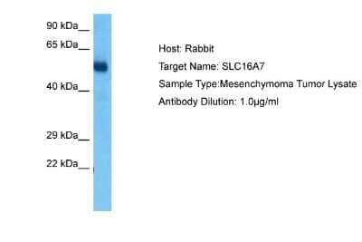 Western Blot: MCT2 Antibody [NBP2-85266]