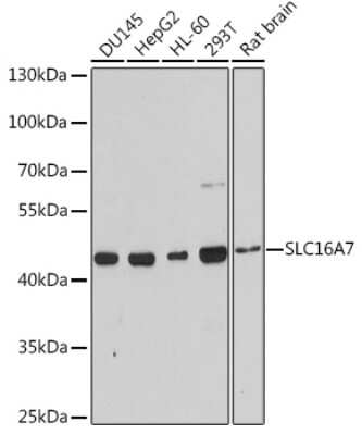 Western Blot: MCT2 AntibodyAzide and BSA Free [NBP3-02987]