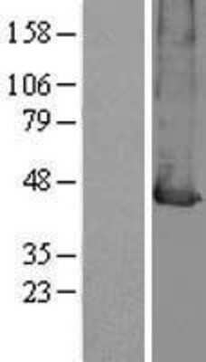 Western Blot: MCT2 Overexpression Lysate [NBP2-04276]