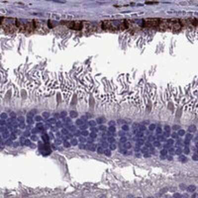 Immunohistochemistry: MCT3/SLC16A8 Antibody [NBP2-68995]