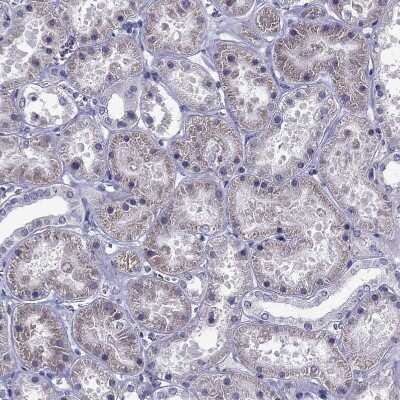 Immunohistochemistry-Paraffin: MCT3/SLC16A8 Antibody [NBP2-68995]