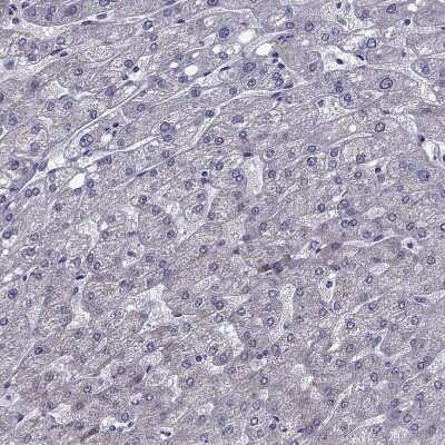 Immunohistochemistry-Paraffin: MCT3/SLC16A8 Antibody [NBP2-68995]