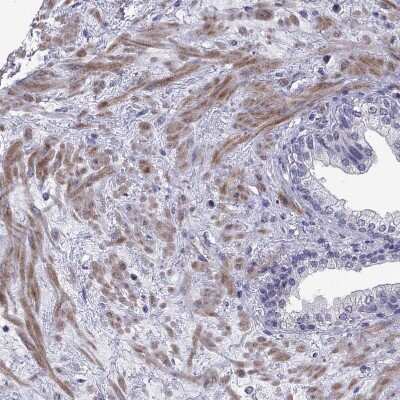 Immunohistochemistry-Paraffin: MCT3/SLC16A8 Antibody [NBP2-68995]