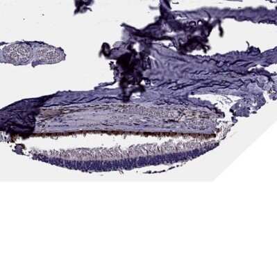 Immunohistochemistry-Paraffin: MCT3/SLC16A8 Antibody [NBP2-68995]