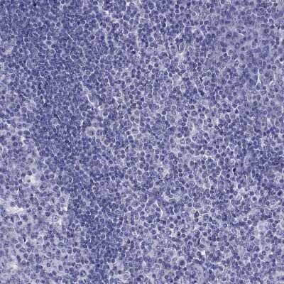 Immunohistochemistry-Paraffin: MCT3/SLC16A8 Antibody [NBP2-68995]