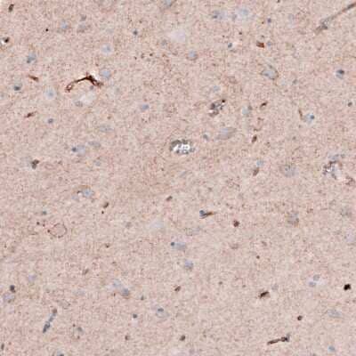 Immunohistochemistry-Paraffin: MCT8/SLC16A2 Antibody [NBP2-57308]