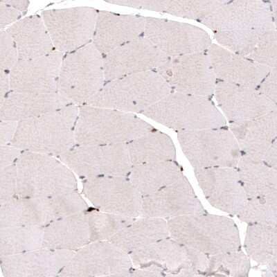 Immunohistochemistry-Paraffin: MCT8/SLC16A2 Antibody [NBP2-57308]