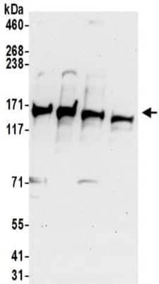 Western Blot: MCT8/SLC16A2 Antibody [NBP2-32109]