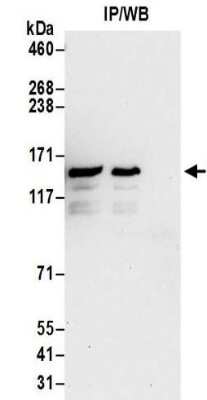 Immunoprecipitation: MCT8/SLC16A2 Antibody [NBP2-32109]
