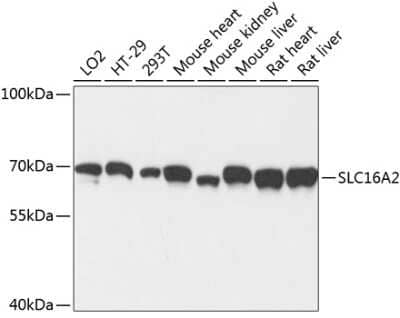 Western Blot: MCT8/SLC16A2 AntibodyAzide and BSA Free [NBP3-03220]