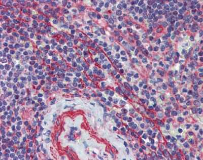 Immunohistochemistry: MCTP1 Antibody [NBP1-59355]
