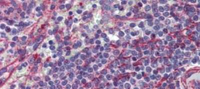 Immunohistochemistry-Paraffin: MCTP1 Antibody [NBP1-59355]