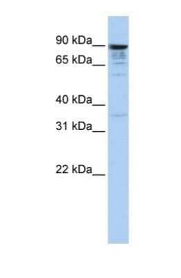 Western Blot: MCTP1 Antibody [NBP1-59355]