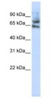 Western Blot: MCTP1 Antibody [NBP1-59908]
