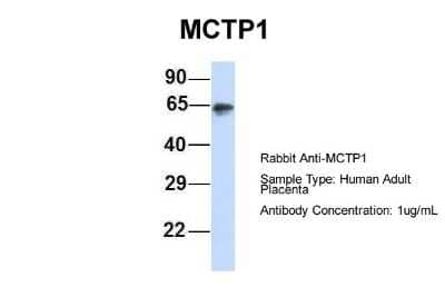 Western Blot: MCTP1 Antibody [NBP1-59908]