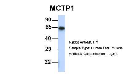 Western Blot: MCTP1 Antibody [NBP1-59908]