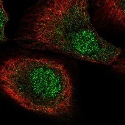 Immunocytochemistry/ Immunofluorescence: MCTP2 Antibody [NBP2-57611]