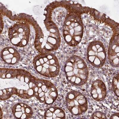 Immunohistochemistry-Paraffin: MCTP2 Antibody [NBP2-33607]